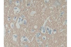 Detection of SNAP25 in Human Cerebrum Tissue using Polyclonal Antibody to Synaptosomal Associated Protein 25 kDa (SNAP25)