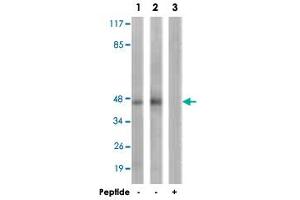 Western blot analysis of extracts from HepG2 cells (Lane 1) and K-562 cells (Lane 2 and 3), using PRKAR2B polyclonal antibody . (PRKAR2B antibody  (Ser113))