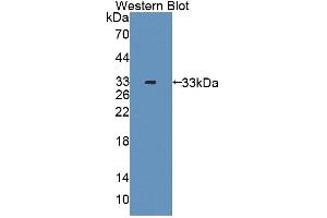 Figure. (BCAT2 antibody  (AA 107-392))