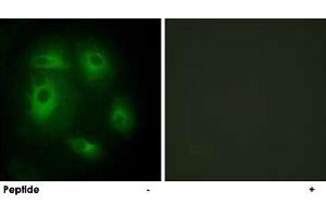 Immunofluorescence analysis of HeLa cells, using DLEC1 polyclonal antibody . (DLEC1 antibody  (N-Term))