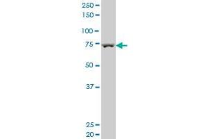 MPHOSPH9 polyclonal antibody (A01), Lot # 050928JC01 Western Blot analysis of MPHOSPH9 expression in HepG2 . (MPHOSPH9 antibody  (AA 922-1031))