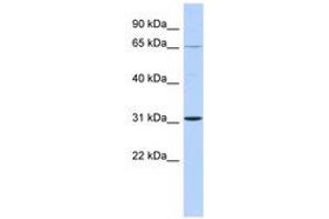 Image no. 1 for anti-Zinc Finger Protein 691 (ZNF691) (C-Term) antibody (ABIN6742831) (ZNF691 antibody  (C-Term))