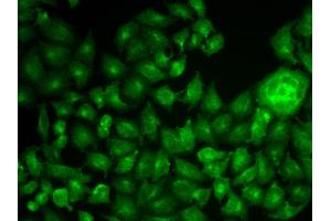 Immunofluorescence analysis of MCF-7 cell using CTTN antibody. (Cortactin antibody)