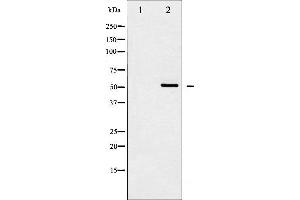 Western blot analysis of Src expression in HeLa whole cell lysates,The lane on the left is treated with the antigen-specific peptide. (Src antibody  (N-Term))