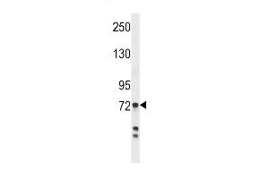 Western blot analysis in MDA-MB231 cell line lysates (35ug/lane). (Myeloperoxidase antibody  (AA 420-448))