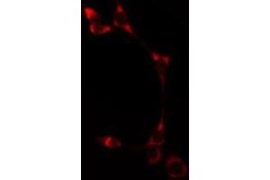 ABIN6275513 staining  HT29 cells by IF/ICC. (ATP2A1/SERCA1 antibody  (Internal Region))