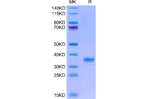 ANTXR2 Protein (AA 32-318) (His tag)