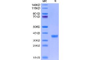 ANTXR2 Protein (AA 32-318) (His tag)