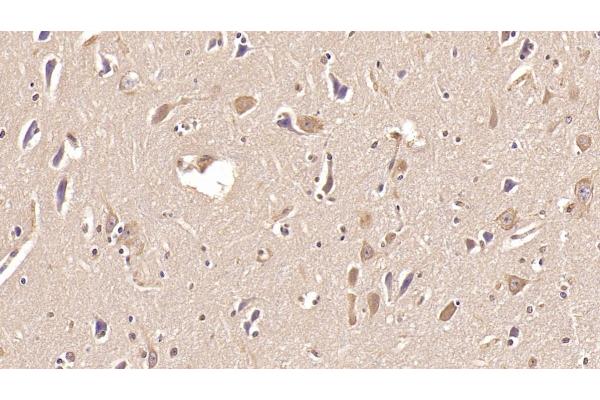 Aspartate beta Hydroxylase antibody  (AA 345-758)
