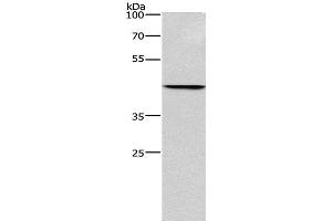 Western Blot analysis of Hela cell using BGN Polyclonal Antibody at dilution of 1:550 (Biglycan antibody)