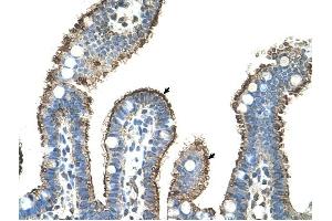 MMP1 antibody was used for immunohistochemistry at a concentration of 4-8 ug/ml to stain Epithelial cells of intestinal villus (arrows) in Human Intestine. (MMP1 antibody)