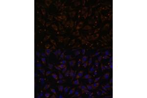 Immunofluorescence analysis of L929 cells using PLLP antibody (ABIN7269390) at dilution of 1:100. (Plasmolipin antibody  (AA 1-100))