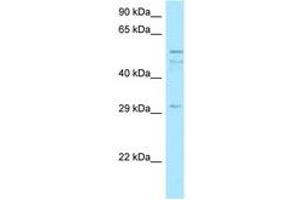 Image no. 1 for anti-Chromosome 11 Open Reading Frame 42 (C11ORF42) (AA 259-308) antibody (ABIN6747983) (C11ORF42 antibody  (AA 259-308))