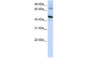 Western Blotting (WB) image for anti-Cytochrome P450, Family 46, Subfamily A, Polypeptide 1 (CYP46A1) antibody (ABIN2458770) (CYP46A1 antibody)