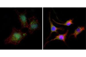 Immunofluorescence analysis of A549 (left) and SK-BR-3 (right) cells using CTNNB1 mouse mAb (green). (CTNNB1 antibody)
