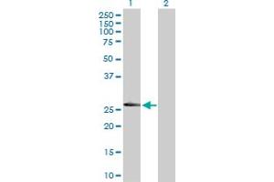 Western Blot analysis of LRRK1 expression in transfected 293T cell line by LRRK1 MaxPab polyclonal antibody. (LRRK1 antibody  (AA 1-261))