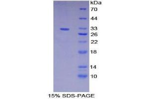 SDS-PAGE (SDS) image for Meprin A, alpha (PABA Peptide Hydrolase) (MEP1A) (AA 219-463) protein (His tag) (ABIN1879557) (MEP1A Protein (AA 219-463) (His tag))