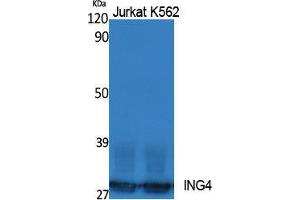 Western Blotting (WB) image for anti-Inhibitor of Growth Family, Member 4 (ING4) (Internal Region) antibody (ABIN3187605) (ING4 antibody  (Internal Region))