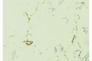 ABIN6276785 at 1/100 staining Human lung tissue by IHC-P. (OLR1 antibody  (N-Term))