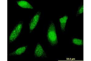 Immunofluorescence of monoclonal antibody to PTTG1IP on HeLa cell. (PTTG1IP antibody  (AA 1-180))