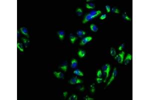 Immunofluorescence staining of Hela cells with ABIN7171142 at 1:66, counter-stained with DAPI. (SNAP23 antibody  (AA 90-196))