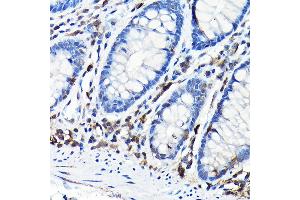 Immunohistochemistry of paraffin-embedded mouse spleen using NLRP1 Rabbit pAb (ABIN7268935) at dilution of 1:100 (40x lens). (NLRP1 antibody  (AA 1000-1100))
