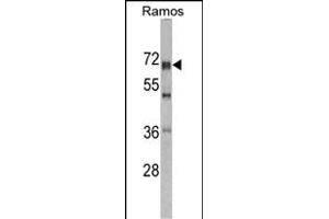 Western blot analysis of DDX5 antibody (Center) (ABIN391669 and ABIN2841580) in Romas cell line lysates (35 μg/lane). (DDX5 antibody  (AA 306-334))
