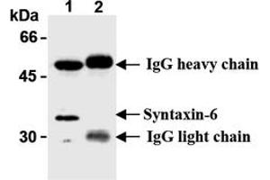 Western Blotting (WB) image for anti-Syntaxin 6 (STX6) antibody (ABIN492572) (Syntaxin 6 antibody)