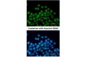 ICC/IF Image Immunofluorescence analysis of paraformaldehyde-fixed mouse ESC D3, using Nkx2. (NK2 Homeobox 5 antibody)