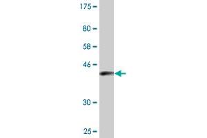Western Blot detection against Immunogen (36. (ENAH antibody  (AA 291-390))