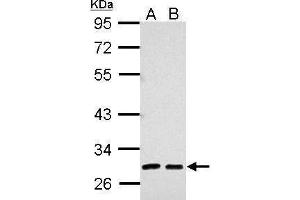 WB Image Sample (30 ug of whole cell lysate) A: 293T B: A431 10% SDS PAGE antibody diluted at 1:5000 (AMBP antibody)