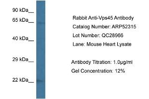 Western Blotting (WB) image for anti-Vacuolar Protein Sorting 45 (VPS45) (C-Term) antibody (ABIN2784878) (VPS45 antibody  (C-Term))