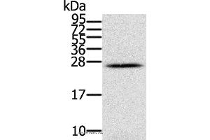 Western blot analysis of Human ovarian cancer, using IFNL3 Polyclonal Antibody at dilution of 1:350