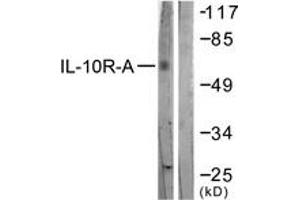Western blot analysis of extracts from HepG2 cells, treated with Na2VO3 0. (IL-10RA antibody  (AA 462-511))