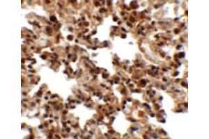 Immunohistochemical analysis of FXYD7 in rat lung tissue with FXYD7 polyclonal antibody  at 2. (FXYD7 antibody  (N-Term))