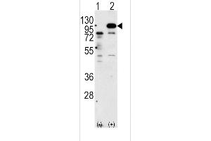 Western blot analysis of P (arrow) using rabbit polyclonal P Antibody (C-term) 6306b. (APP antibody  (C-Term))