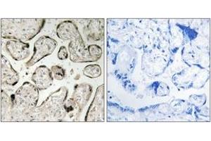 Immunohistochemistry analysis of paraffin-embedded human placenta tissue, using GIMAP5 Antibody. (GIMAP5 antibody  (AA 231-280))