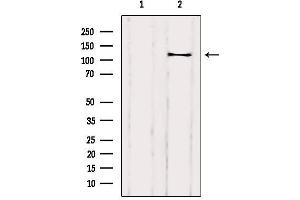 Western blot analysis of extracts from Rat heart, using DAAM1 Antibody. (DAAM1 antibody  (Internal Region))