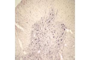 IHC on rat spinal cord using Rabbit antibody to extracellular, N-terminal part of Sortilin (Neurotensin receptor 3, NTR3, Sort1): IgG (ABIN350868) at a concentration of 10 µg/ml. (Sortilin 1 antibody)