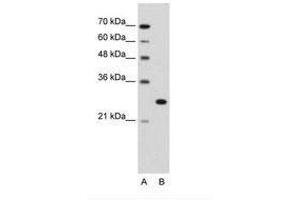 Image no. 2 for anti-Forkhead Box R2 (FOXR2) (AA 82-131) antibody (ABIN203387) (FOXR2 antibody  (AA 82-131))