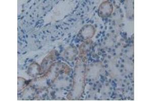 Detection of PAI2 in Rat Kidney Tissue using Monoclonal Antibody to Plasminogen Activator Inhibitor 2 (PAI2) (SERPINB2 antibody  (AA 154-408))