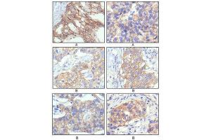 Immunohistochemistry (IHC) image for anti-Receptor tyrosine-protein kinase erbB-2 (ErbB2/Her2) antibody (ABIN1845273) (ErbB2/Her2 antibody)
