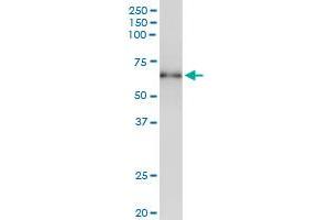 Immunoprecipitation of STK17A transfected lysate using anti-STK17A MaxPab rabbit polyclonal antibody and Protein A Magnetic Bead , and immunoblotted with STK17A MaxPab mouse polyclonal antibody (B01) . (STK17A antibody  (AA 1-414))