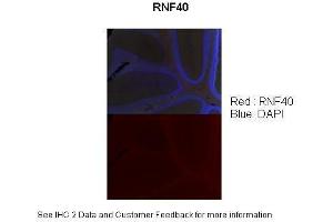Sample Type :  Adult mouse cerebellum (l0x) section  Primary Antibody Dilution :  1:100  Secondary Antibody :  Donkey Anti-rabbit (568 nm)  Secondary Antibody Dilution :  1:500  Color/Signal Descriptions :  RNF40: Red DAPI:Blue  Gene Name :  RNF40  Submitted by :  Anonymous (RNF40 antibody  (C-Term))
