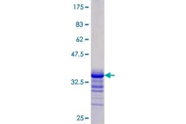 JAG1 Protein (AA 37-119) (GST tag)