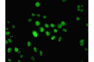 Immunofluorescent analysis of HepG2 cells using ABIN7156655 at dilution of 1:100 and Alexa Fluor 488-congugated AffiniPure Goat Anti-Rabbit IgG(H+L) (IFI44 antibody  (AA 101-300))