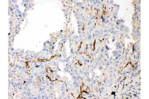 IHC analysis of Bcl-XL using anti-Bcl-XL antibody . (BCL2L1 antibody  (AA 1-219))