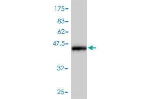 Western Blot detection against Immunogen (47. (CSRP2 antibody  (AA 1-193))