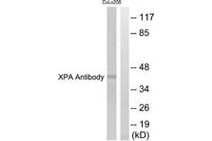 Western blot analysis of extracts from COLO205 cells, using XPA Antibody. (PA (AA 211-260) antibody)