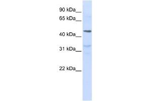 IL28R alpha antibody used at 1 ug/ml to detect target protein. (IL28RA antibody)